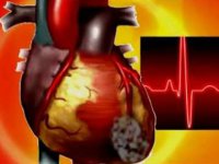 Простуда может стать причиной инфаркта?